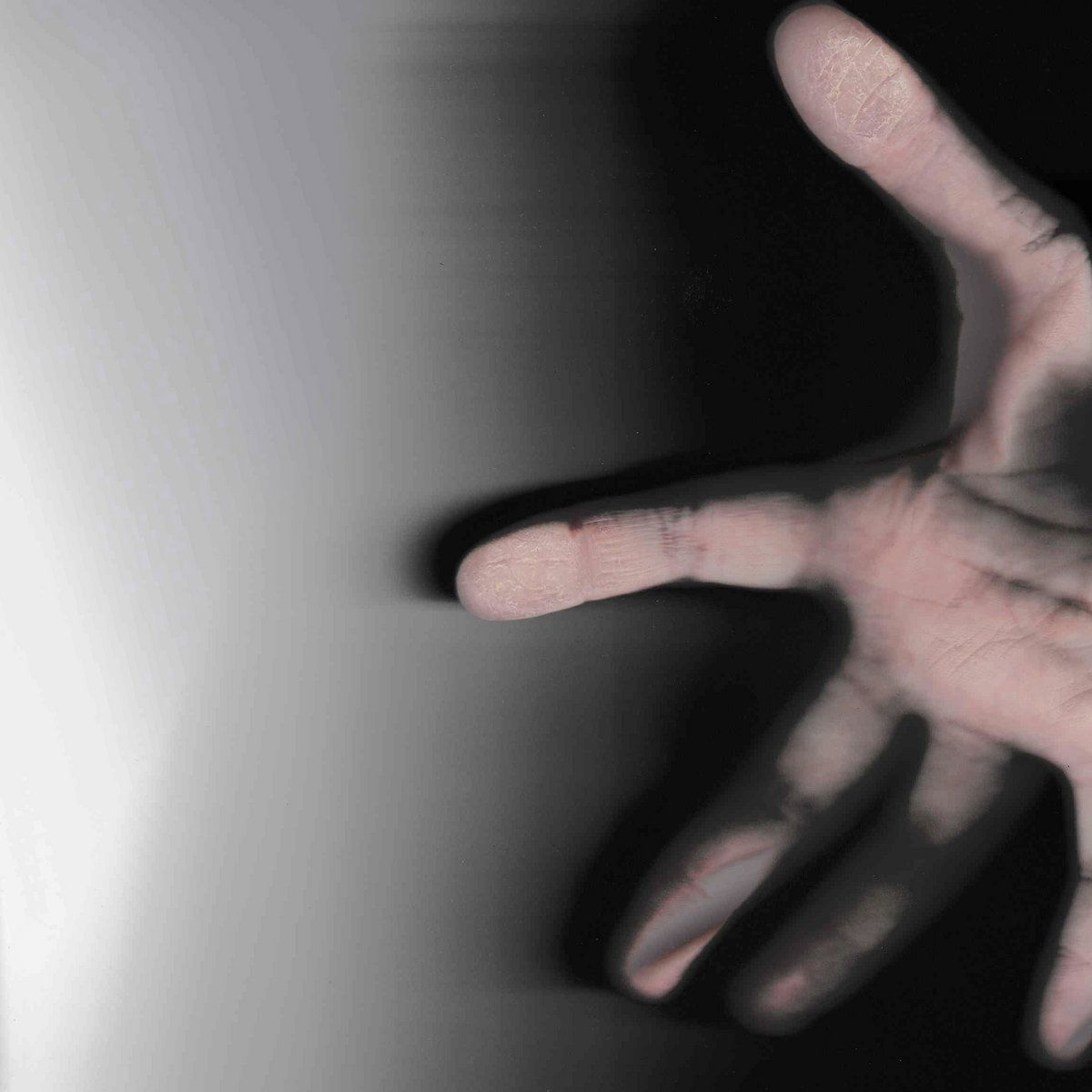 Sur fond dégradé de blanc à noir de gauche à droite, une main appuyée contre la vitre d'un scanner qui laisse apparaître des lésions sur la pulpe du pouce et de l'index.